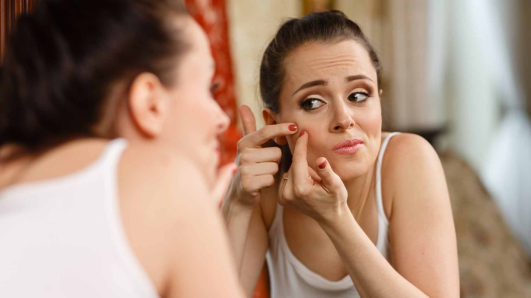 The quick way to reduce pimples naturally