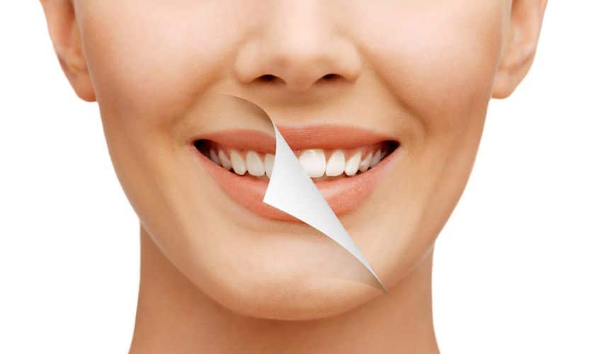 Celebrity Smile Secrets Revealed: How Your Favorite Stars Maintain Their Picture-Perfect Grins